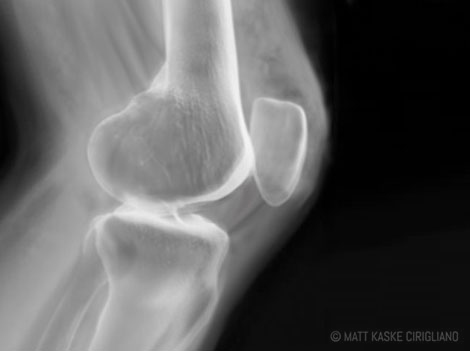 X-Ray-Knee.jpg